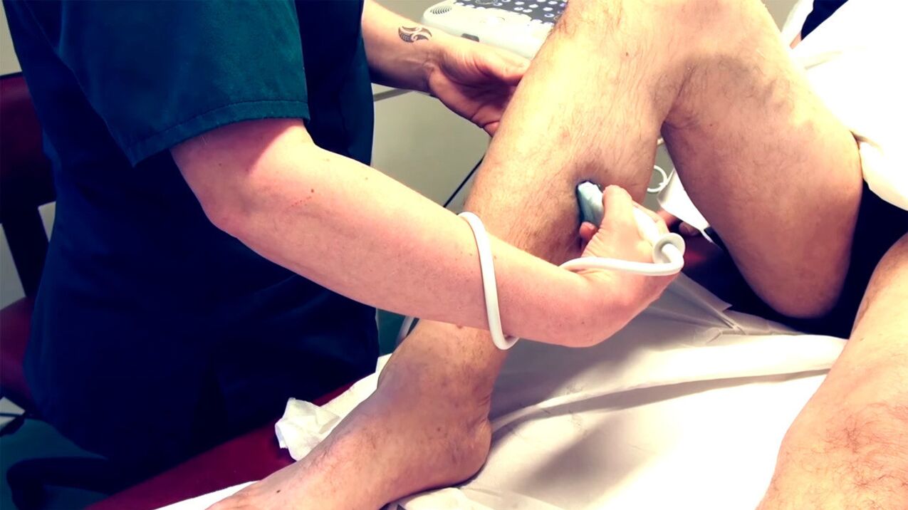 Duplex scan of the lower extremity veins for the diagnosis of varicose veins
