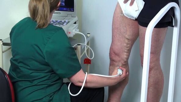 ultrasound diagnostics of varicose veins