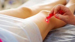 The laser treatment